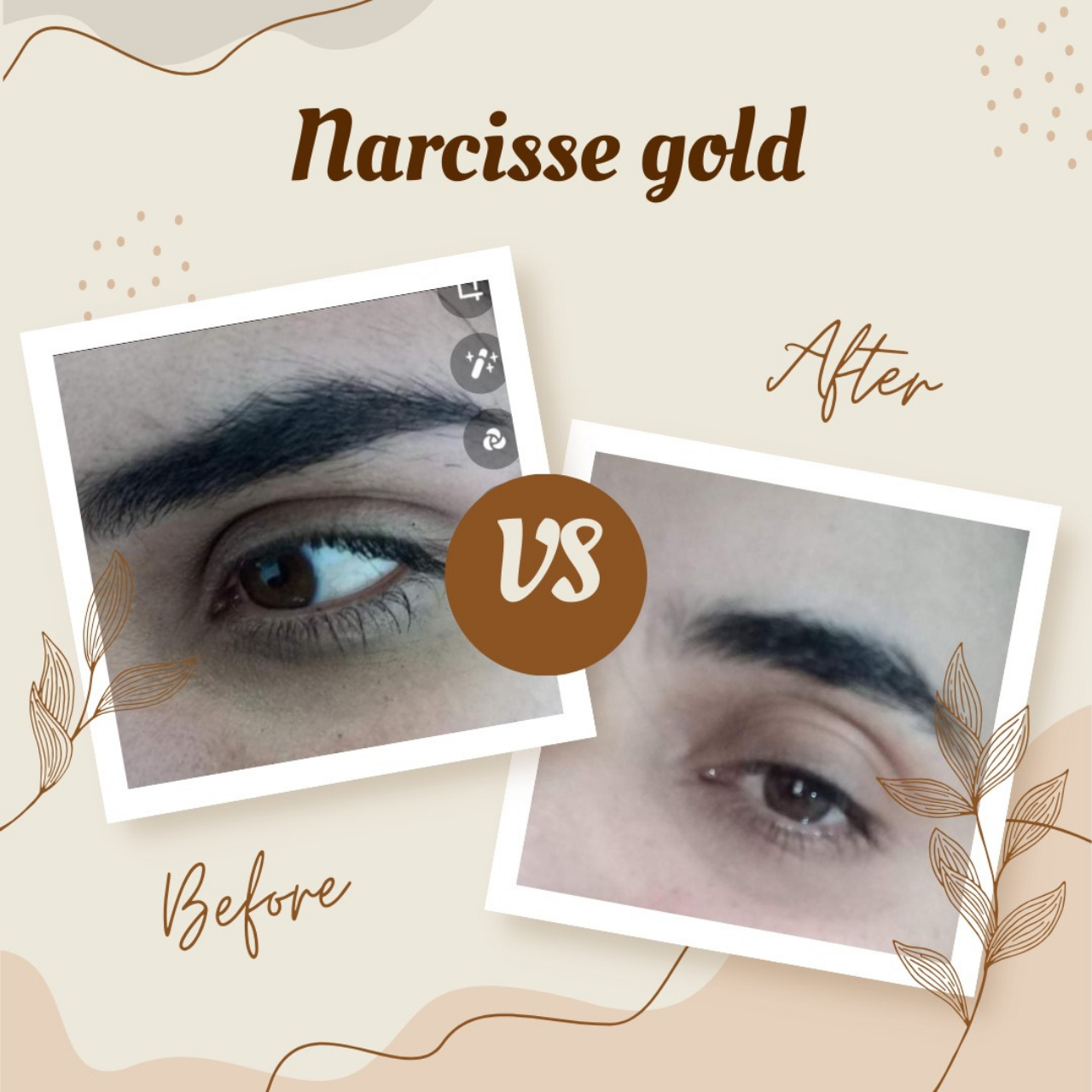 Sérum Contour des yeux